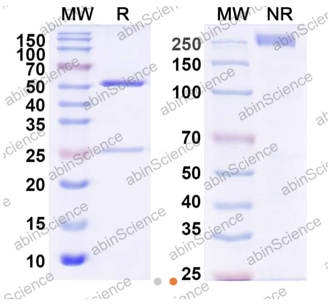AbinScience InVivoMAb Anti-Nipah virus/NiV Prefusion Protein Antibody (1H1) (VK521060-1MG)