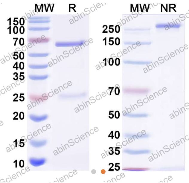 AbinScience InVivoMAb Anti-HBV-A S/L-HBsAg/L glycoprotein Antibody (Iv0154) (VK539030-1MG)