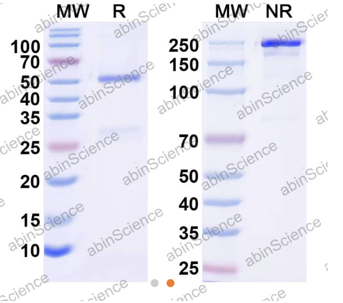 AbinScience InVivoMAb Anti-Human Proadrenomedullin/Pro-ADM Antibody (Iv0159) (HW442010-1MG)