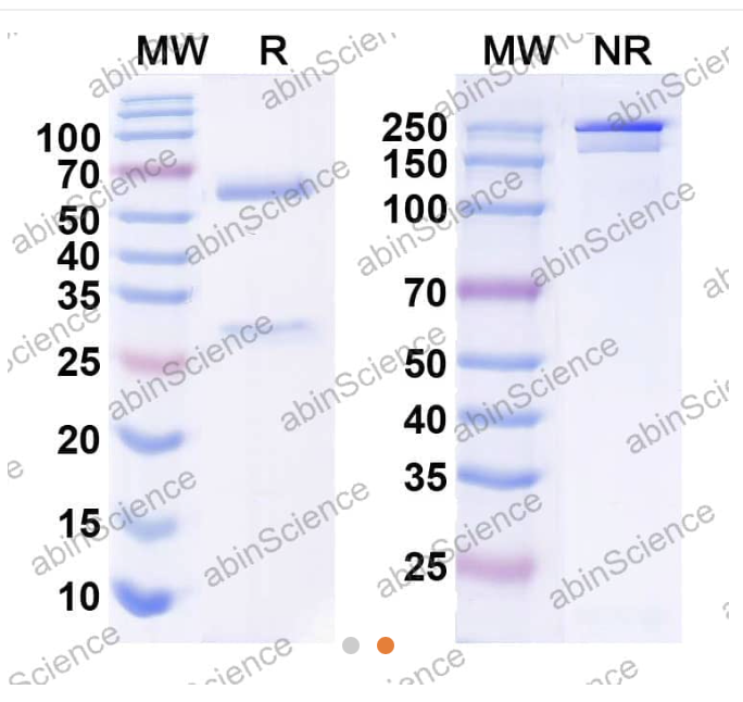 Abinscience InVivoMAb Anti-Human Leptin R Antibody (9F8) (HW637010-1mg)