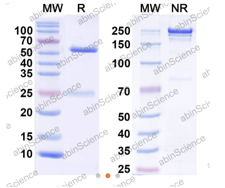 Abinscience InVivoMAb Anti-Human Tryptase alpha/beta1 Antibody (31A) (HS931010-1mg)