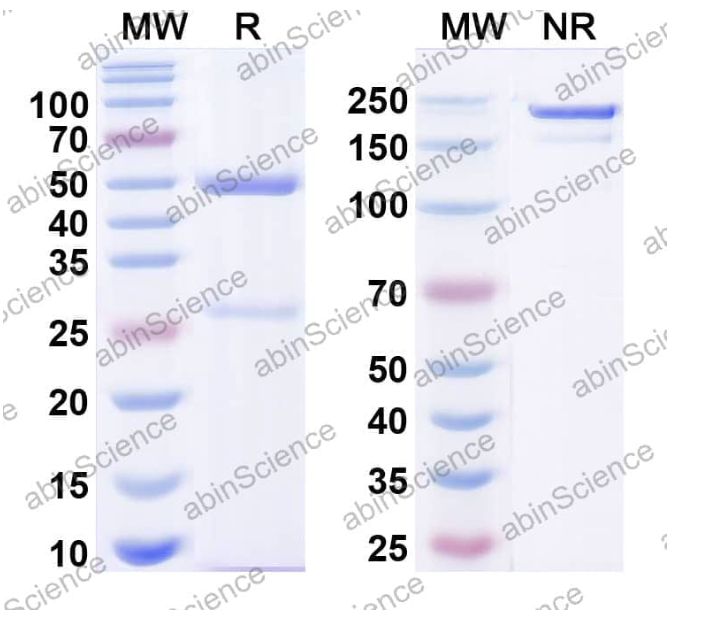 Abinscience InVivoMAb Anti-Human Angiopoietin-like Protein 4/ANGPTL4 Antibody (Iv0129) (HV344010-1mg)