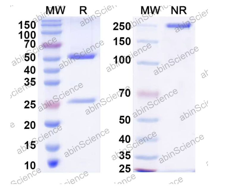 Abinscience InVivoMAb Anti-HCV NS1/gp68/gp70/Envelope glycoprotein E2 Antibody (RM2-01) (VK681010-1mg)