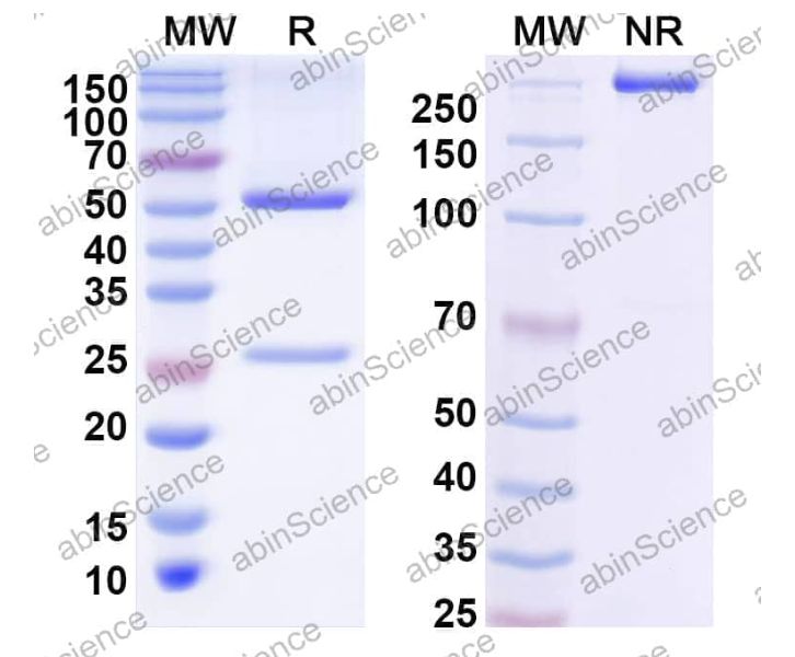 Abinscience InVivoMAb Anti-DENV-1/2/3/4 Envelope protein E/DII-FL region Antibody (1C19) (VK589050-1mg)