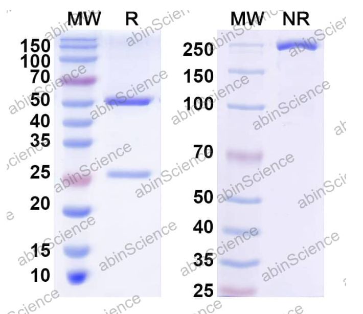 Abinscience InVivoMAb Anti-Clostridium botulinum botA/BoNT Antibody (BNTA-9.1) (JN888010-1mg)