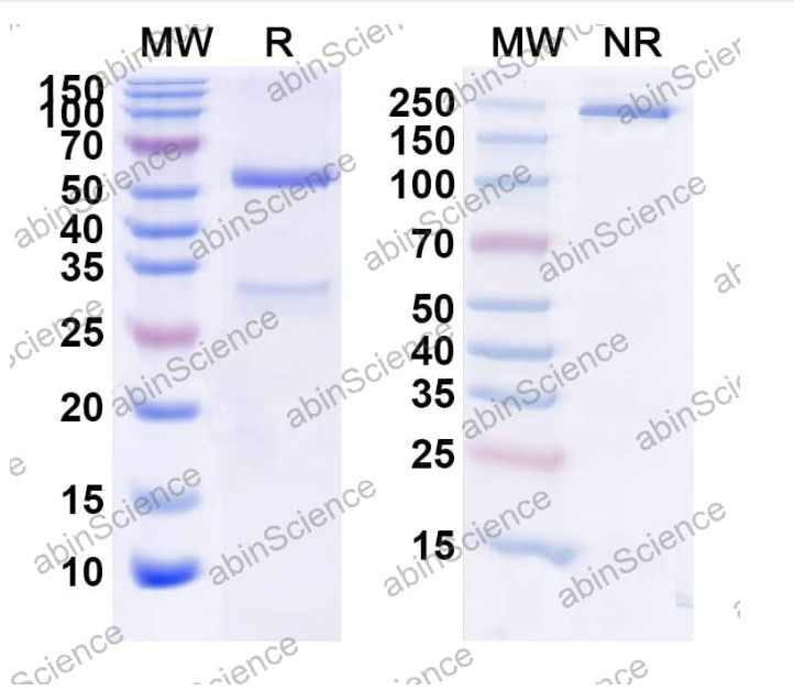 Abinscience InVivoMAb Anti-Mouse IFN-gamma Antibody (XMG1.2) (MF813010-1mg)
