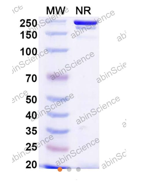 Abinscience Anti-Human TREM2 Reference Antibody (al002, RUO) (HV166016)