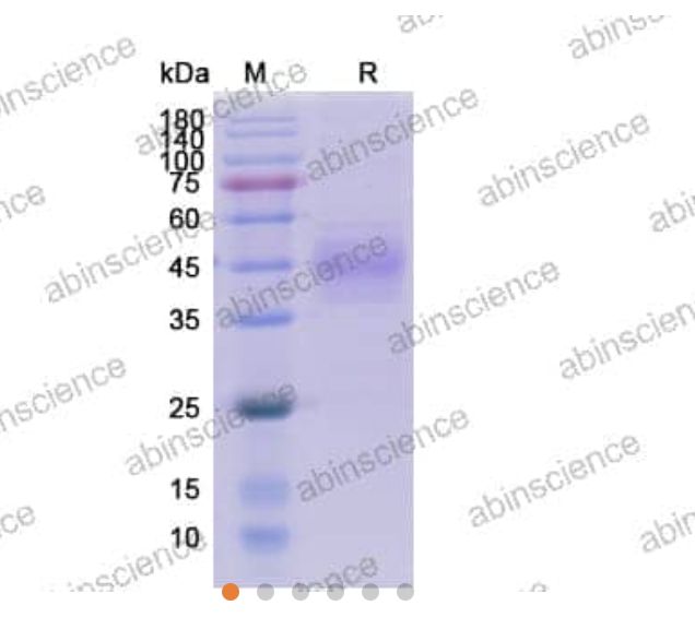 Abinscience Human Siglec-3/CD33 Recombinant Protein (C-His) (HB185011)