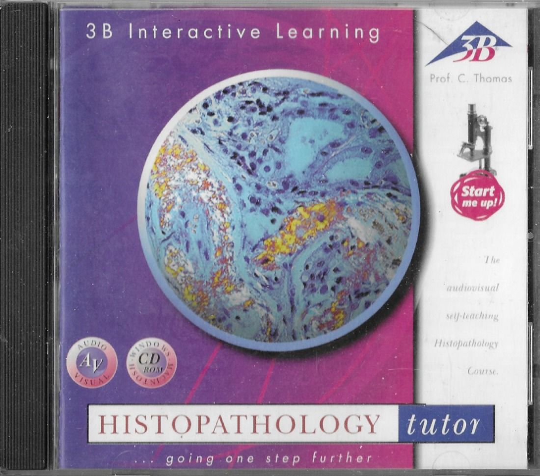 Histopathology | CD | En