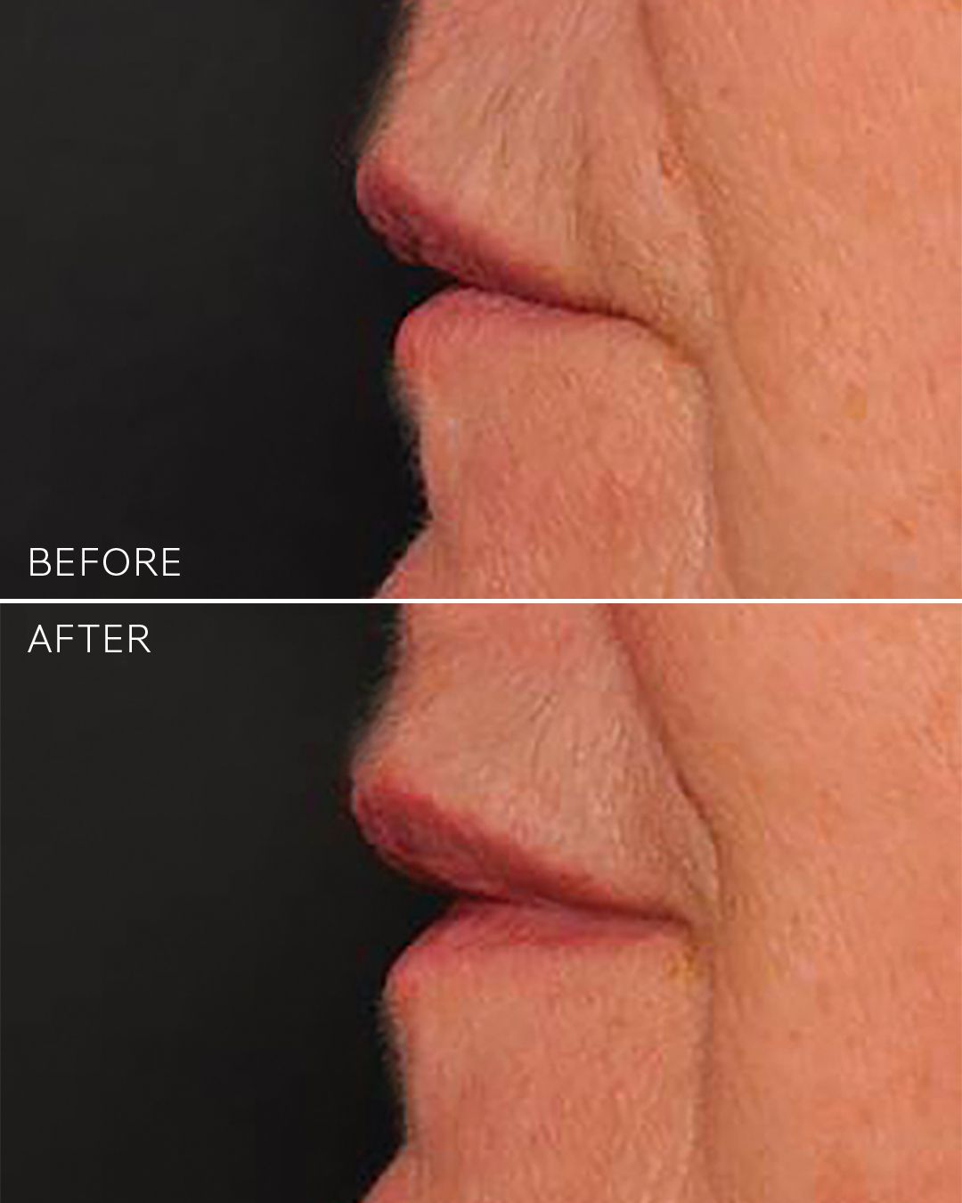 Hydra Volume Lip Plumping Serum, 15 ml