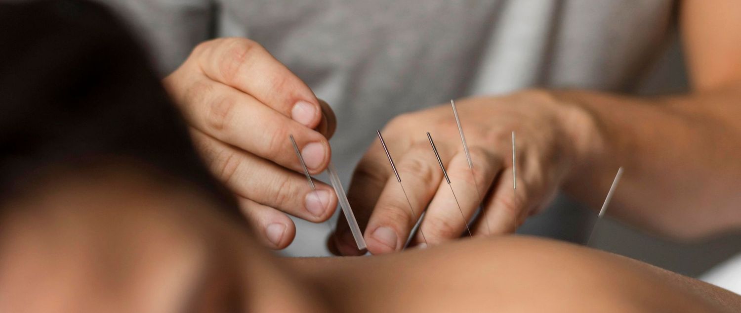 TRACTAMENT del DOLOR amb ACUPUNTURA segons els FACTORS CLIMÀTICS en MTC aa