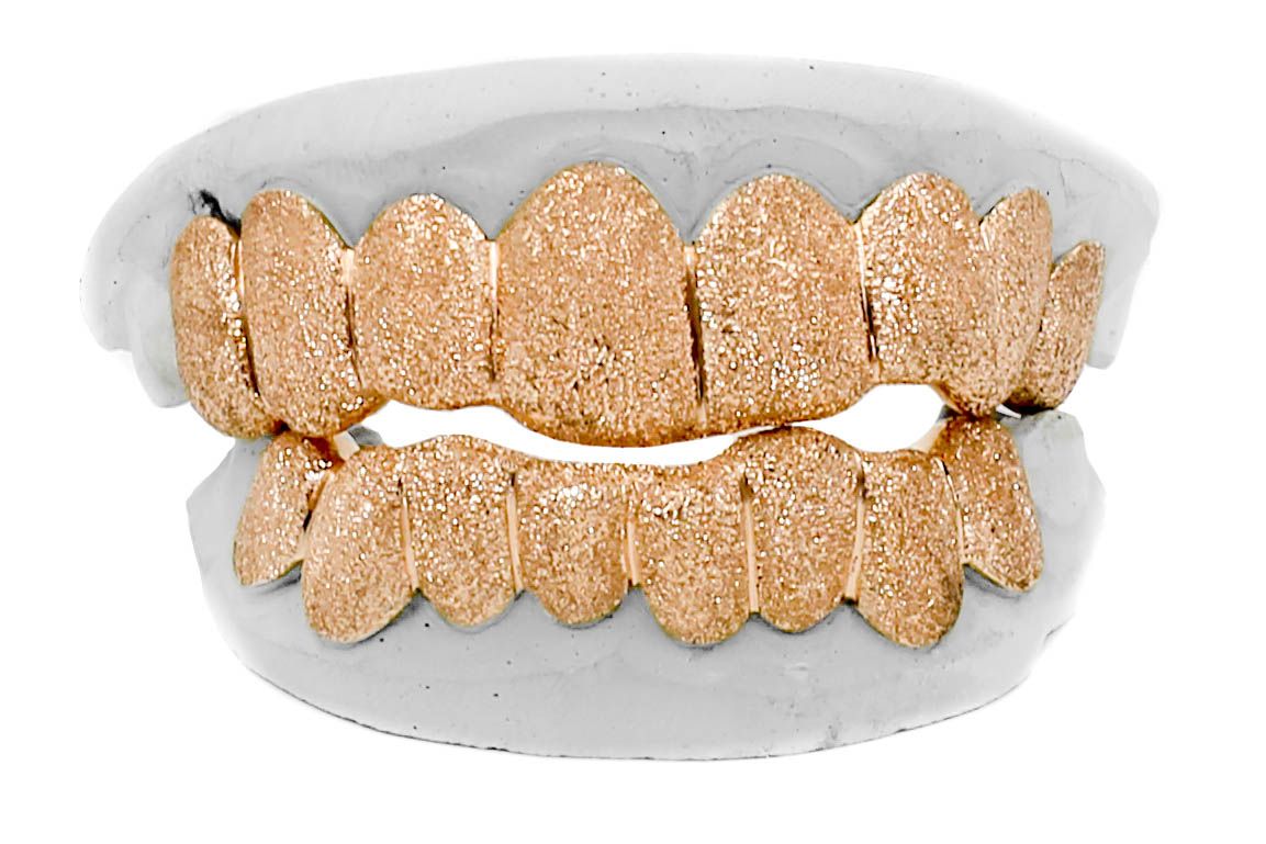 Diamond Dust Grillz