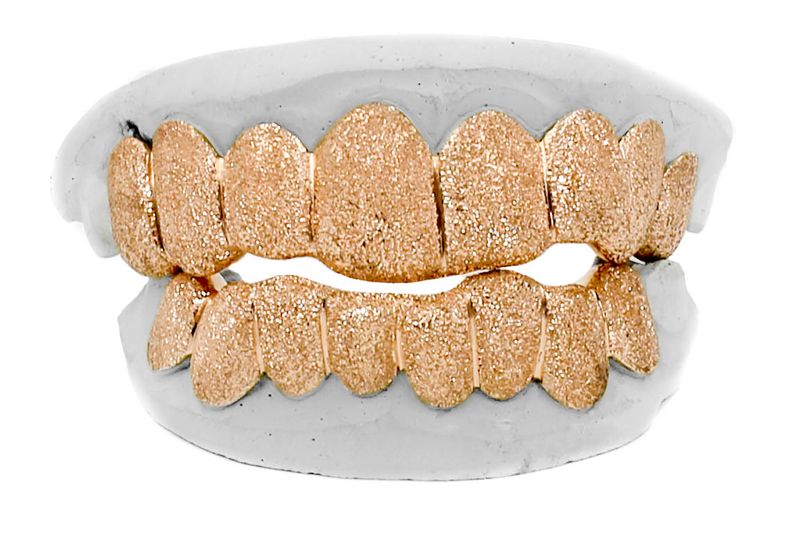 Diamond Dust Grillz