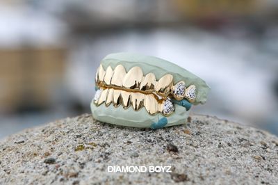 Custom Trill Cuts Gold Grillz (18 Pack)