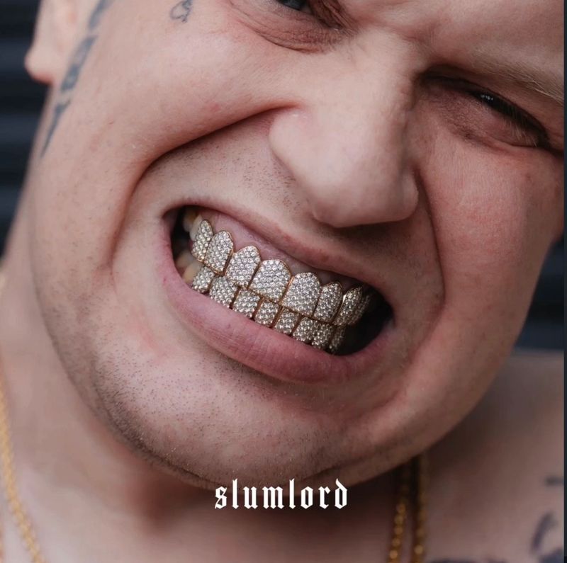 SideNeck Virgin Set Grillz