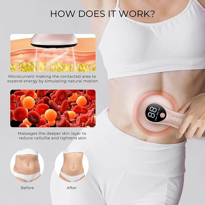 Oranmagic Cellulite Massager Body Sculpting Machin
