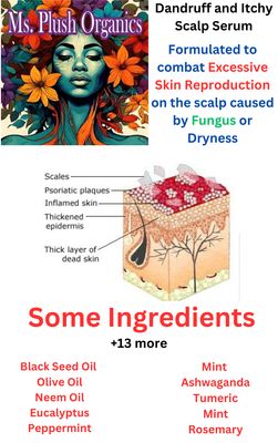 Dandruff and Itchy Scalp Oil