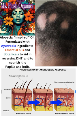 Alopecia Oil/Scalp Serum