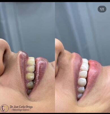 Diseño sonrisa