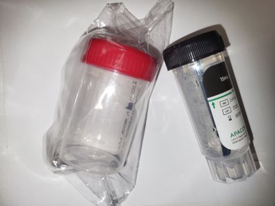 Calprotectina, parásitos, Helicobarter pylori, coprocultivo, elastasa fecal