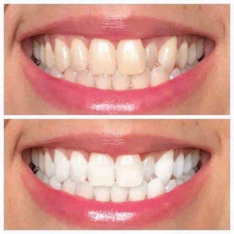 AP 24® Whitening Toothpaste