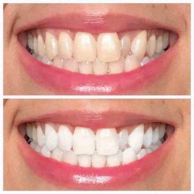AP 24® Whitening Toothpaste
