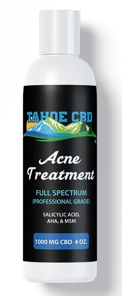 Tahoe CBD Acne Treatment~1000mg CBD 8 oz.