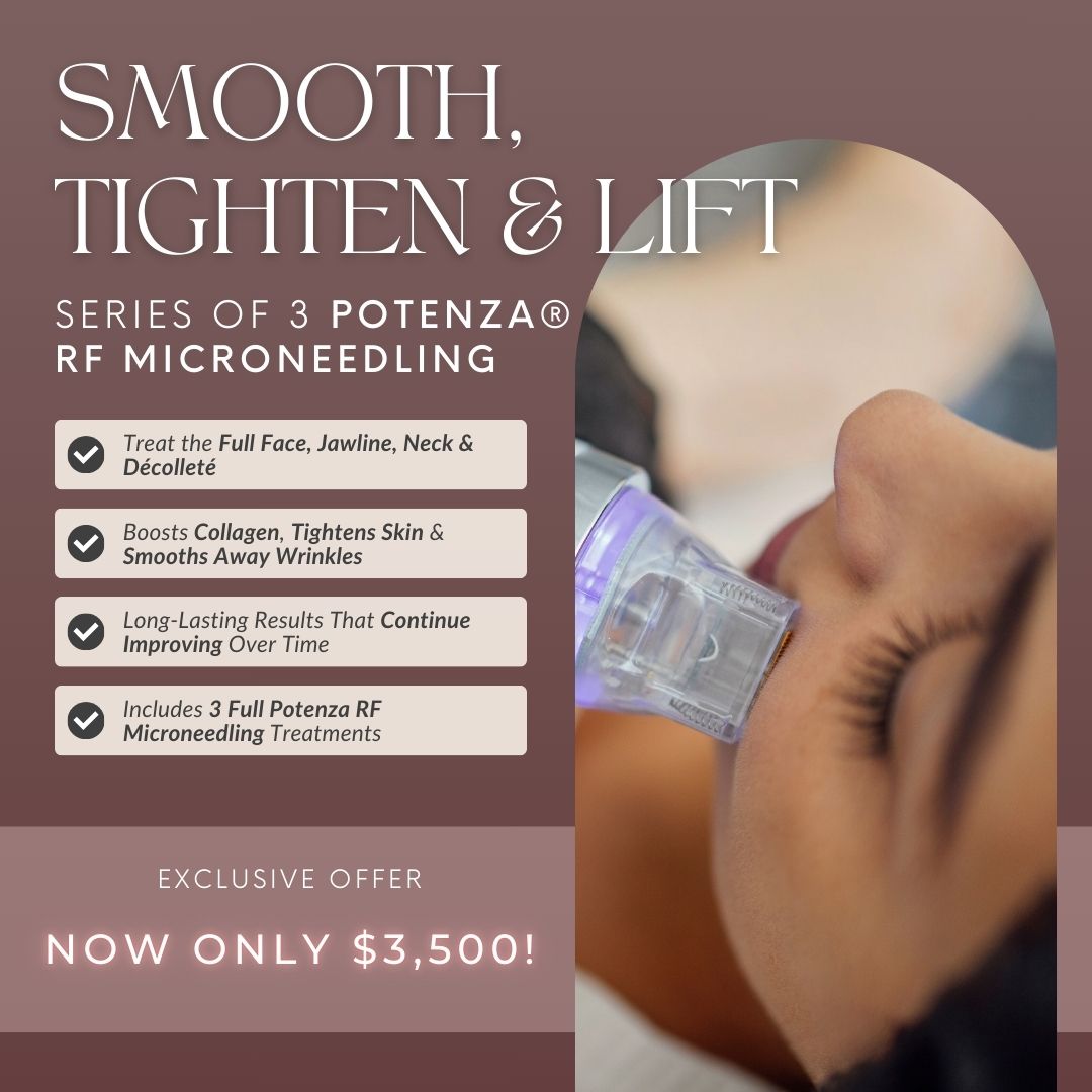Potenza® RF Microneedling | Series of 3 Face, Neck &amp; Décolleté Treatments