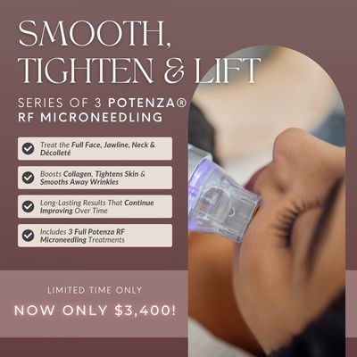 Potenza® RF Microneedling | Series of 3 Face, Neck &amp; Décolleté Treatments