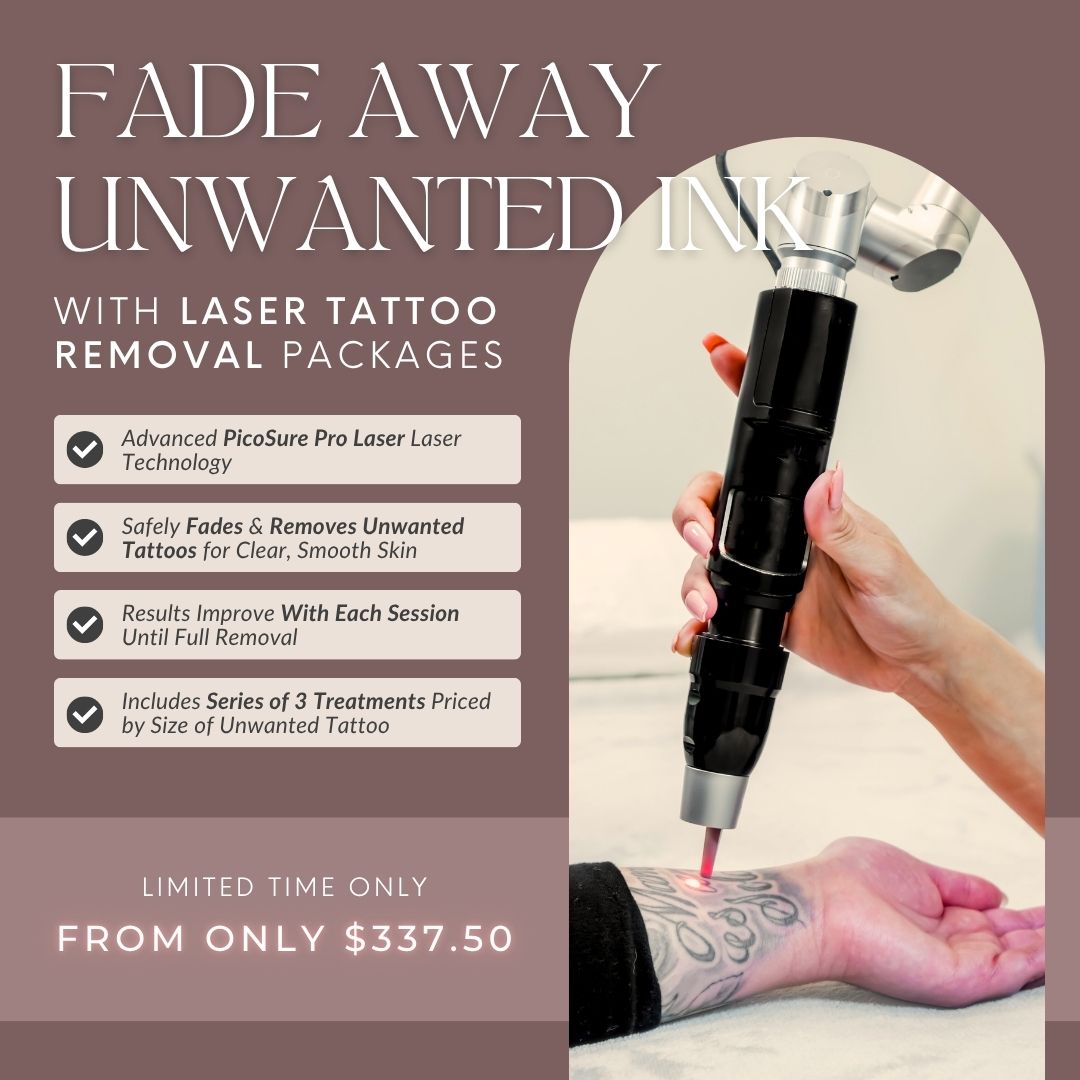 Laser Tattoo Removal | Package of 3 Treatments