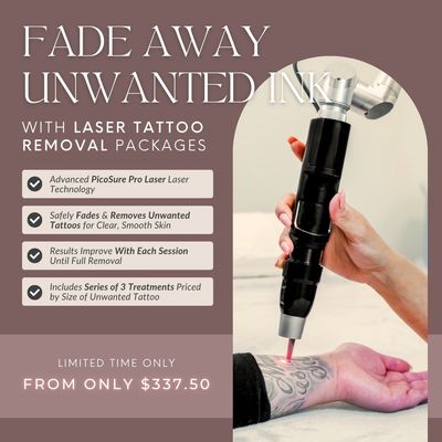 Laser Tattoo Removal | Package of 3 Treatments