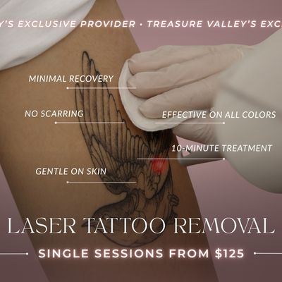 Laser Tattoo Removal | Single Sessions
