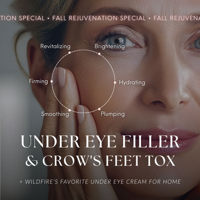 Under Eyes Package | Filler Treatment + Crow&#39;s Feet Tox &amp; Alastin&#39;s Restorative Eye Cream for Home