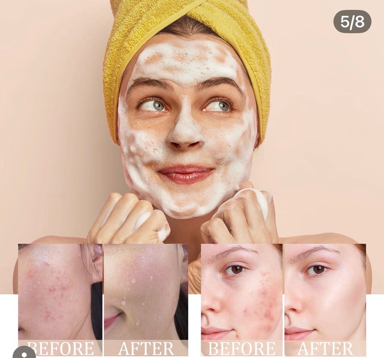 Mousse Nettoyante Visage au Curcuma – Pureté &amp; Éclat Naturel