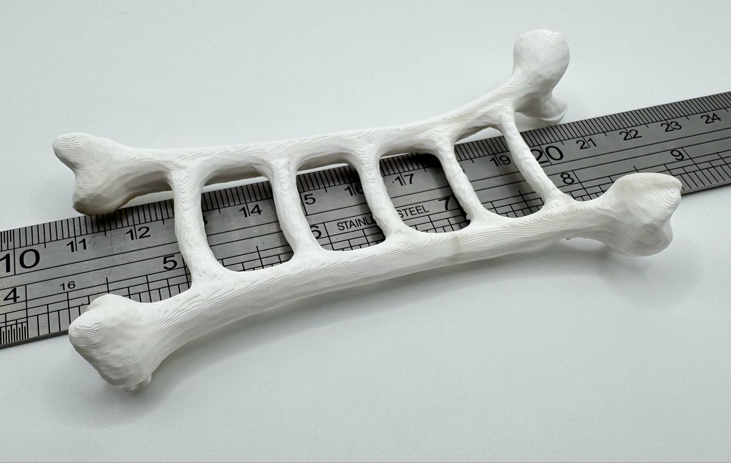 Bone Ladder