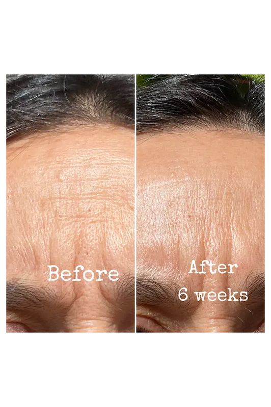 Retinol &amp; Lactic Resurfacing Treatment
