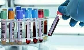 CANDIDA IMMUNOGLOBULINS (IgG, IgA, IgM) CANDIDA IMMUNOGLOBULINS (IgG, IgA, IgM)