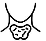Hashimoto&#39;s Thyroiditis