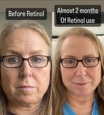 ageLOC® Tru Face® Peptide Retinol + ageLOC® Future Serum Bundle