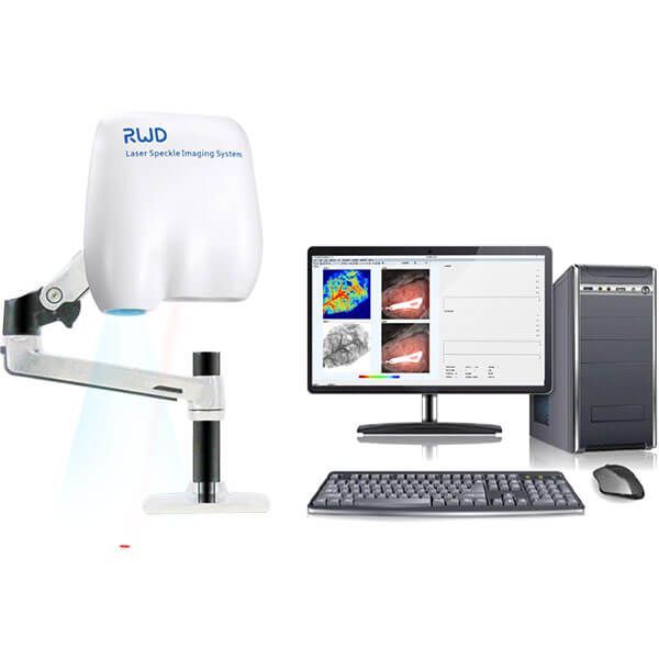 Laser Speckle Imaging System (RFLSI III)