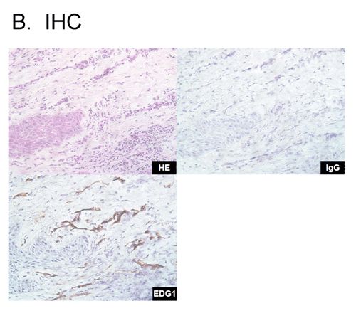 Anti-Huamn sphingosine 1-phosphate receptor 1 (S1PR1) Mouse Monoclonal Antibody (DBOA10006), 100 ug