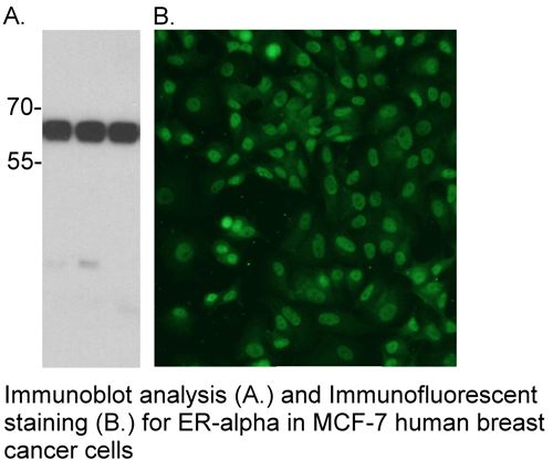 Anti-Human Estrogen Receptor alpha (ER-α) Mouse Monoclonal Antibody (DBOA10005), 100 ug