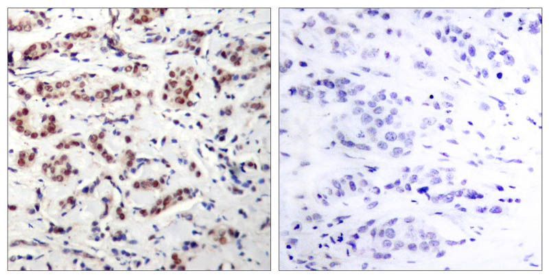 STAT5A (Phospho-Tyr694) Rabbit Polyclonal Antibody, 100 ug