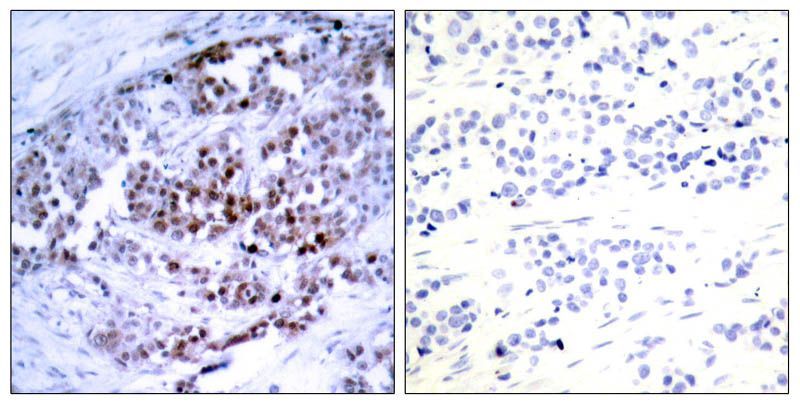 BCL-2(Phospho-Ser70) Rabbit Polyclonal Antibody, 100 ug