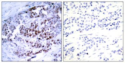 BCL-2(Phospho-Ser70) Rabbit Polyclonal Antibody, 100 ug BCL-2(Phospho-Ser70) Rabbit Polyclonal Antibody, 100 ug
