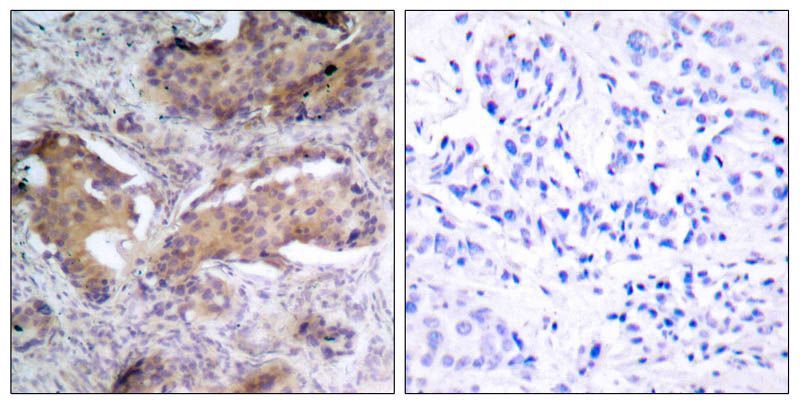 PTEN(Phospho-Ser370) Rabbit Polyclonal Antibody, 100 ug