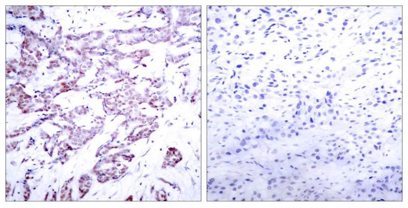 STAT6 (Phospho-Thr645) Rabbit Polyclonal Antibody, 100 ug