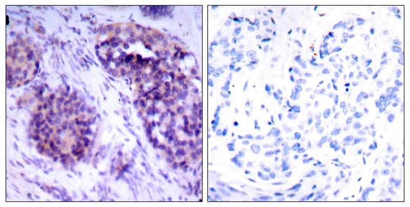 BCL-XL (Phospho-Ser62) Rabbit Polyclonal Antibody, 100 ug