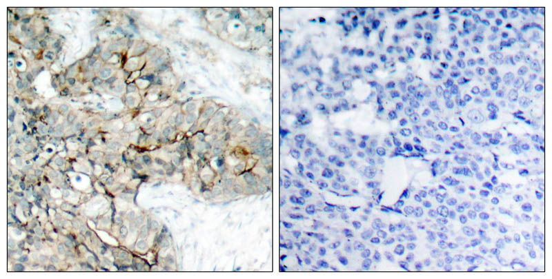 Integrin β3 (Phospho-Tyr773) Rabbit Polyclonal Antibody, 100 ug