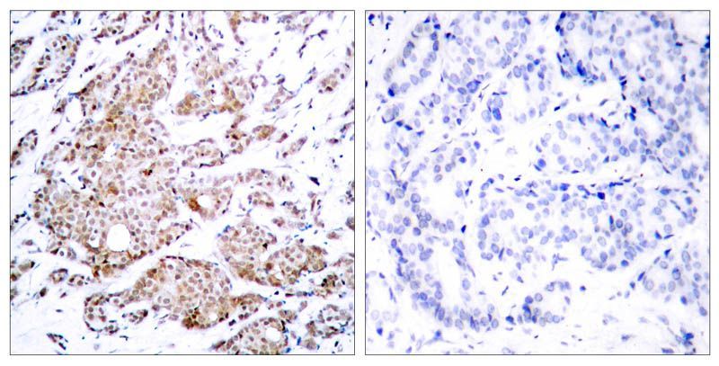 Myc (Phospho-Thr58) Rabbit Polyclonal Antibody, 100 ug